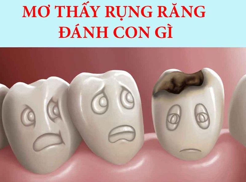 Nằm mơ thấy rụng răng đánh số mấy khả năng thắng lớn ?