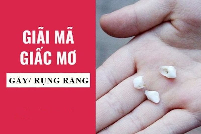 Nằm mơ thấy rụng răng đánh số mấy khả năng thắng lớn ?